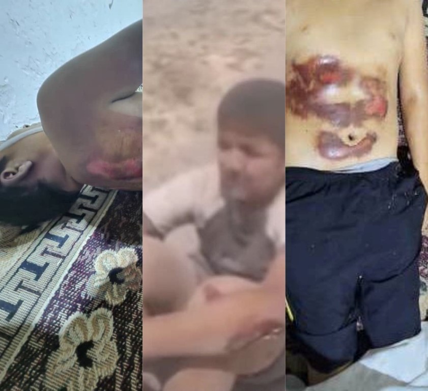 Падар барои шиканҷа ва ба марг расонидани писари 15-солааш боздошт шуд